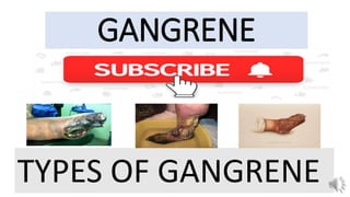 GANGRENE
TYPES OF GANGRENE
 