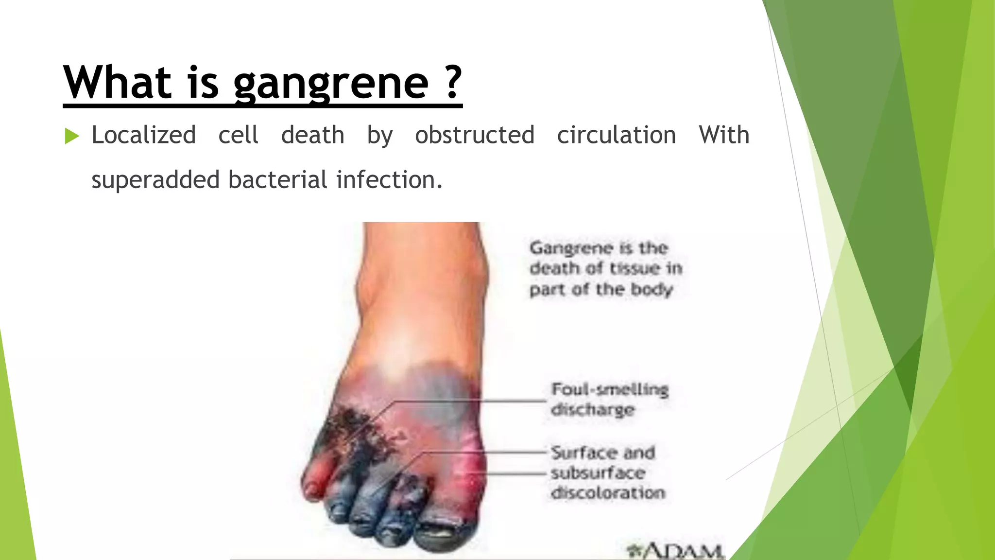 Gangrene | PPTX, image size:2048x1152
