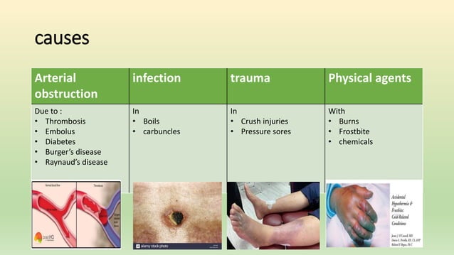 Gangrene | PPT