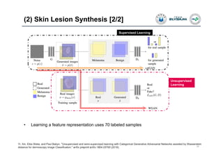 (2) Skin Lesion Synthesis [2/2]
29
Yi, Xin, Ekta Walia, and Paul Babyn. "Unsupervised and semi-supervised learning with Categorical Generative Adversarial Networks assisted by Wasserstein
distance for dermoscopy image Classification." arXiv preprint arXiv:1804.03700 (2018).
Supervised Learning
Unsupervised
Learning
• Learning a feature representation uses 70 labeled samples
 
