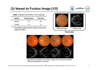 (3) Vessel to Fundus Image [1/2]
30Costa, Pedro, et al. "End-to-end adversarial retinal image synthesis." IEEE transactions on medical imaging 37.3 (2018): 781-791.
Dataset Training pairs Test pairs
DRIVE 40 20
STARE 10 10
Fig. Random samples of eye fundus images and corresponding vessel
networks generated by the model.
Table. Statistics information of the datasets
Paired data
Retinal image Vessel map• Annotated medical data is often scarce and
costly to obtain.
 