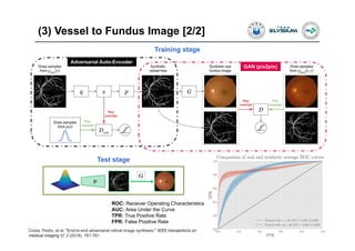 (3) Vessel to Fundus Image [2/2]
31
Test stage
Training stage
GAN (pix2pix)
Adversarial Auto-Encoder
Costa, Pedro, et al. "End-to-end adversarial retinal image synthesis." IEEE transactions on
medical imaging 37.3 (2018): 781-791.
ROC: Receiver Operating Characteristics
AUC: Area Under the Curve
TPR: True Positive Rate
FPR: False Positive Rate
 