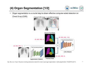 (4) Organ Segmentation [1/2]
32
• Organ segmentation is a crucial step to obtain effective computer-aided detection on
Chest X-ray (CXR).
Dai, Wei, et al. "Scan: Structure correcting adversarial network for chest x-rays organ segmentation." arXiv preprint arXiv:1703.08770 (2017).
Original CXR image Lung field annotation
(N, 400, 400, 1)
(N, 400, 400, 4)
(N, 400, 400, 4)
(N, 400, 400, 1+4)
 