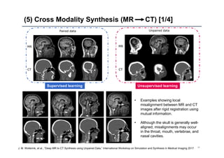 (5) Cross Modality Synthesis (MR CT) [1/4]
34J. M. Wolterink, et al., “Deep MR to CT Synthesis using Unpaired Data,” International Workshop on Simulation and Synthesis in Medical Imaging 2017
Supervised learning Unsupervised learning
• Examples showing local
misalignment between MR and CT
images after rigid registration using
mutual information.
• Although the skull is generally well-
aligned, misalignments may occur
in the throat, mouth, vertebrae, and
nasal cavities.
 