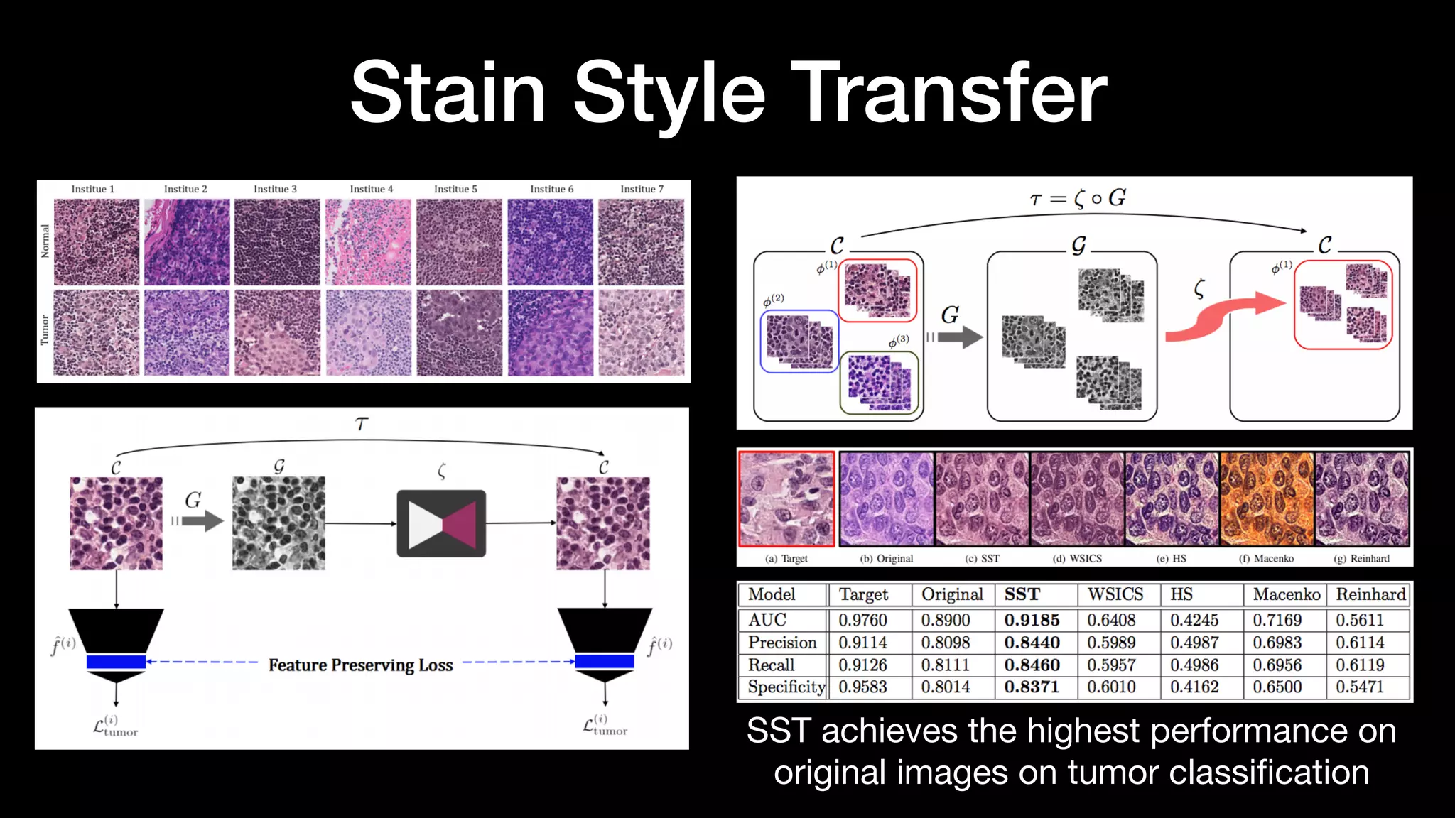 Stain Style Transfer
SST achieves the highest performance on
original images on tumor classiﬁcation
 