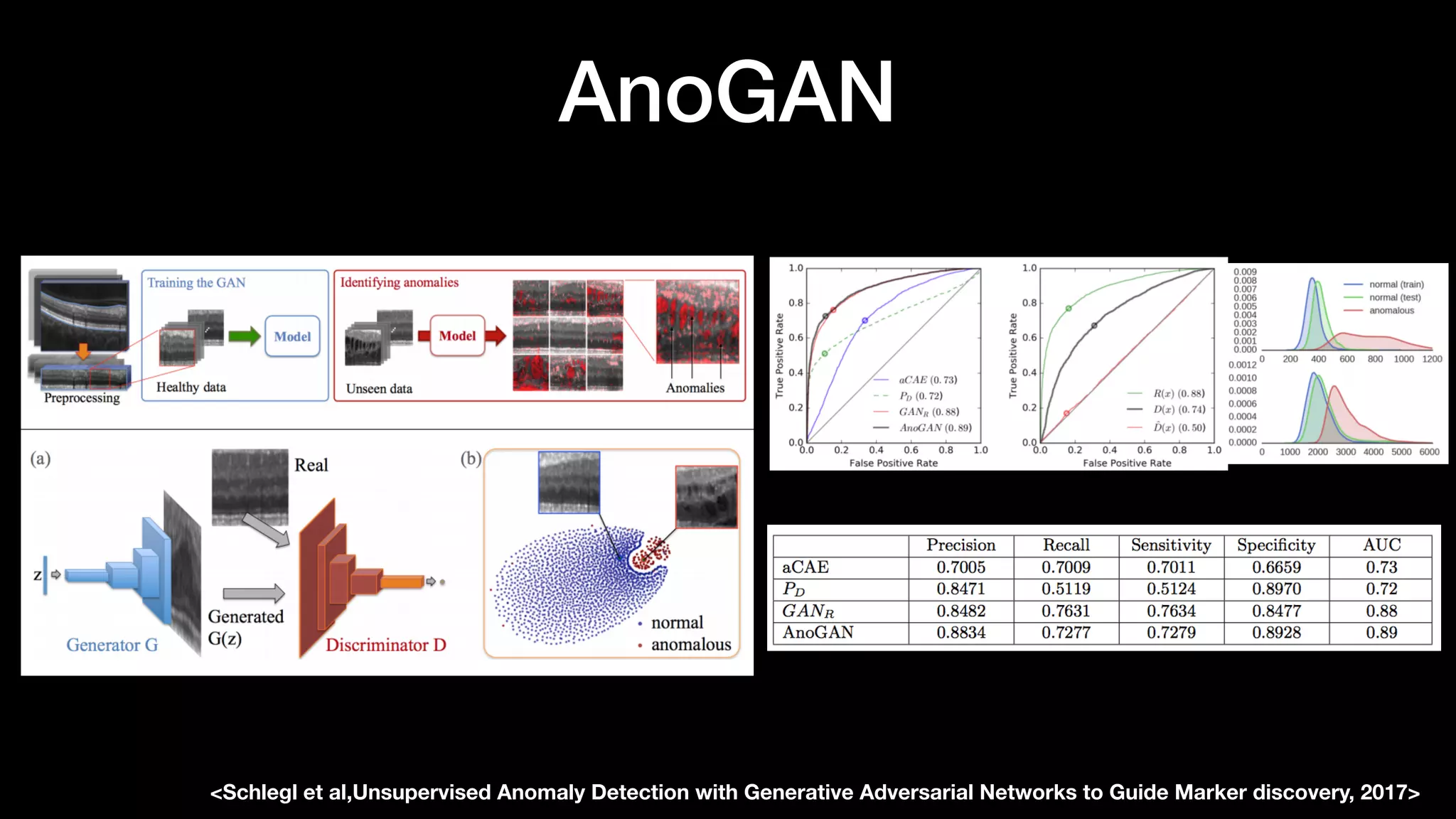 AnoGAN
<Schlegl et al,Unsupervised Anomaly Detection with Generative Adversarial Networks to Guide Marker discovery, 2017>
 