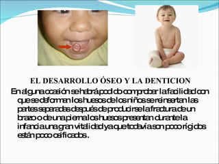 EL DESARROLLO ÓSEO Y LA DENTICION
En a unao a ió s ha ráp d o c m ro a lafa ilid dc n
    lg    c s n e b o id o p b r          c a o
 q s d fo a lo hue o d lo niño s re e n la
  ue e e rm n s s s e s          s e ins rta s
 p rte s p ra a d s ué d p d irs lafra turad un
  a s e a d s e p s e ro uc e         c     e
 b zo o d unap rnalo hue o p s nta d ntela
  ra     e      ie     s s s re e n ura
 infa iaunag n vita a yaq to a s n p c ríg o
     nc       ra    lid d  ue d vía o o o id s
 e tá p c o ific d s.
  s n oo s ao
 