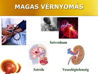 MAGAS VÉRNYOMÁS




             Szívroham




    Sztrók         Veseelégtelenség
 
