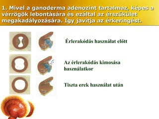 1. Mivel a ganoderma adenozint tartalmaz, képes a
vérrögök lebontására és ezáltal az érszűkület
megakadályozására. Így javítja az érkeringést.


                    Érlerakódás használat előtt


                    Az érlerakódás kimosása
                    használatkor


                    Tiszta erek használat után
 