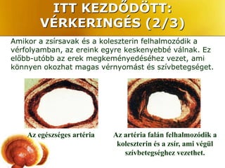 ITT KEZDŐDÖTT:
       VÉRKERINGÉS (2/3)
Amikor a zsírsavak és a koleszterin felhalmozódik a
vérfolyamban, az ereink egyre keskenyebbé válnak. Ez
előbb-utóbb az erek megkeményedéséhez vezet, ami
könnyen okozhat magas vérnyomást és szívbetegséget.




    Az egészséges artéria   Az artéria falán felhalmozódik a
                             koleszterin és a zsír, ami végül
                               szívbetegséghez vezethet.
 