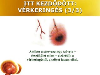 ITT KEZDŐDÖTT:
VÉRKERINGÉS (3/3)




   Amikor a szervezet egy szövete –
     érszűkület miatt – elzáródik a
  vérkeringéstől, a szövet lassan elhal.
 