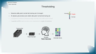 Thresholding
Approccio Proposto
Patch-Ganomaly
> Estazione delle patch normali dal training set di immagini
> Si valutano gli anomaly score relativi alle patch normali del traning set
> L'istogramma mostra la frequenza degli anomaly score delle patch normali
> Il quantile al 95% degli anomaly score rappresenta la soglia di decisione
Training Set
Patch Normali Modello
Patch-Ganomaly
Anomaly Score
Normale
Anomalia
Soglia
 
