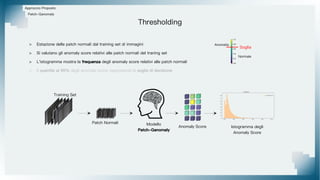 Thresholding
Approccio Proposto
Patch-Ganomaly
Training Set
Patch Normali Modello
Patch-Ganomaly
Anomaly Score Istogramma degli
Anomaly Score
Normale
Anomalia
Soglia
> Estazione delle patch normali dal training set di immagini
> Si valutano gli anomaly score relativi alle patch normali del traning set
> L'istogramma mostra la frequenza degli anomaly score relativi alle patch normali
> Il quantile al 95% degli anomaly score rappresenta la soglia di decisione
 