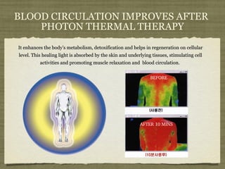BLOOD CIRCULATION IMPROVES AFTER  PHOTON THERMAL THERAPY It enhances the body’s metabolism, detoxification and helps in regeneration on cellular level. This healing light is absorbed by the skin and underlying tissues, stimulating cell activities and promoting muscle relaxation and  blood circulation.  BEFORE AFTER 10 MINS 