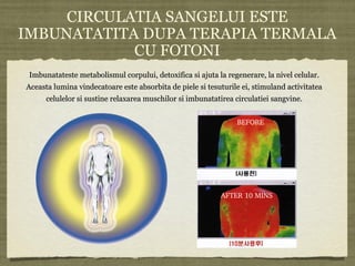 CIRCULATIA SANGELUI ESTE
IMBUNATATITA DUPA TERAPIA TERMALA
CU FOTONI
Imbunatateste metabolismul corpului, detoxifica si ajuta la regenerare, la nivel celular.Imbunatateste metabolismul corpului, detoxifica si ajuta la regenerare, la nivel celular.
Aceasta lumina vindecatoare este absorbita de piele si tesuturile ei, stimuland activitateaAceasta lumina vindecatoare este absorbita de piele si tesuturile ei, stimuland activitatea
celulelor si sustine relaxarea muschilor si imbunatatirea circulatiei sangvine.celulelor si sustine relaxarea muschilor si imbunatatirea circulatiei sangvine.
BEFORE
AFTER 10 MINS
 