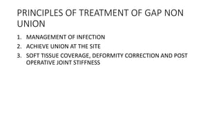 PRINCIPLES OF TREATMENT OF GAP NON
UNION
1. MANAGEMENT OF INFECTION
2. ACHIEVE UNION AT THE SITE
3. SOFT TISSUE COVERAGE, DEFORMITY CORRECTION AND POST
OPERATIVE JOINT STIFFNESS
 