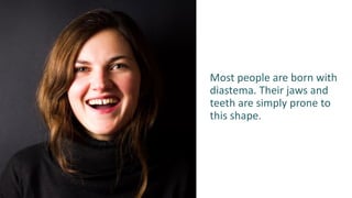 Most people are born with
diastema. Their jaws and
teeth are simply prone to
this shape.
 