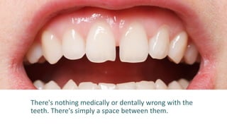 There's nothing medically or dentally wrong with the
teeth. There's simply a space between them.
 