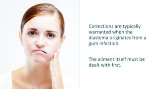Corrections are typically
warranted when the
diastema originates from a
gum infection.
The ailment itself must be
dealt with first.
 