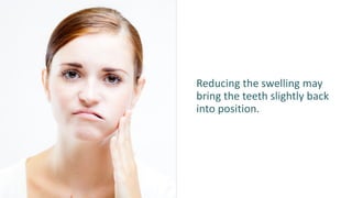 Reducing the swelling may
bring the teeth slightly back
into position.
 