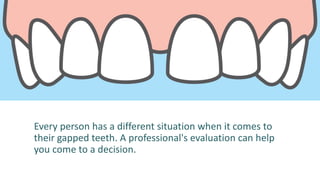 Every person has a different situation when it comes to
their gapped teeth. A professional's evaluation can help
you come to a decision.
 