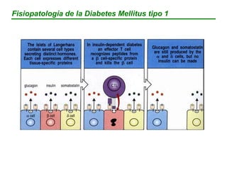 Fisiopatología de la Diabetes Mellitus tipo 1
 