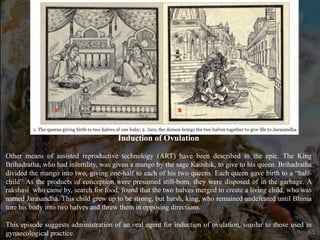 Induction of Ovulation
Other means of assisted reproductive technology (ART) have been described in the epic. The King
Brihadratha, who had infertility, was given a mango by the sage Kaushik, to give to his queen. Brihadratha
divided the mango into two, giving one-half to each of his two queens. Each queen gave birth to a “half-
child” As the products of conception were presumed still-born, they were disposed of in the garbage. A
rakshasi who came by, search for food, found that the two halves merged to create a living child, who was
named Jarasandha. This child grew up to be strong, but harsh, king, who remained undefeated until Bhima
tore his body into two halves and threw them in opposing directions.
This episode suggests administration of an oral agent for induction of ovulation, similar to those used in
gynaecological practice. 61
 