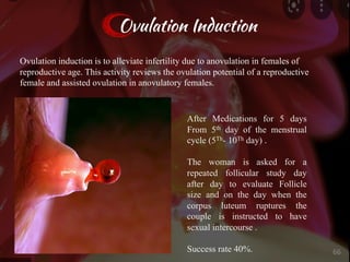 Ovulation Induction
Ovulation induction is to alleviate infertility due to anovulation in females of
reproductive age. This activity reviews the ovulation potential of a reproductive
female and assisted ovulation in anovulatory females.
After Medications for 5 days
From 5th day of the menstrual
cycle (5Th- 10Th day) .
The woman is asked for a
repeated follicular study day
after day to evaluate Follicle
size and on the day when the
corpus luteum ruptures the
couple is instructed to have
sexual intercourse .
Success rate 40%. 66
 
