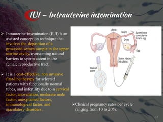 IUI – Intrauterine insemination
Ø Intrauterine insemination (IUI) is an
assisted conception technique that
involves the deposition of a
processed semen sample in the upper
uterine cavity, overcoming natural
barriers to sperm ascent in the
female reproductive tract.
Ø It is a cost-effective, non invasive
first-line therapy for selected
patients with functionally normal
tubes, and infertility due to a cervical
factor, anovulation, moderate male
factor, unexplained factors,
immunological factor, and
ejaculatory disorders .
ØClinical pregnancy rates per cycle
ranging from 10 to 20%.
67
 