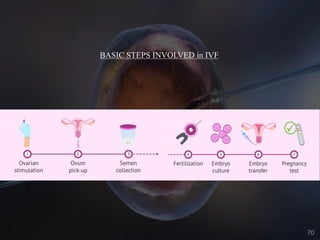 BASIC STEPS INVOLVED in IVF
70
 