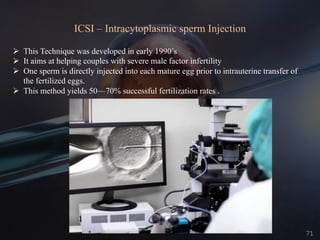 ICSI – Intracytoplasmic sperm Injection
Ø This Technique was developed in early 1990’s
Ø It aims at helping couples with severe male factor infertility
Ø One sperm is directly injected into each mature egg prior to intrauterine transfer of
the fertilized eggs.
Ø This method yields 50—70% successful fertilization rates .
71
 