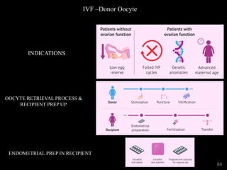 IVF –Donor Oocyte
INDICATIONS
OOCYTE RETRIEVAL PROCESS &
RECIPIENT PREP UP
ENDOMETRIAL PREP IN RECIPIENT
84
 