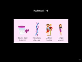 Reciprocal IVF
83
 