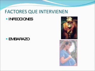 FACTORES QUE INTERVIENEN INFECCIONES EMBARAZO 