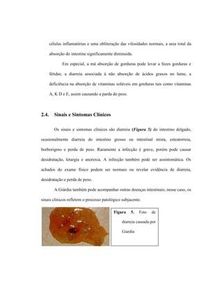 células inflamatórias e uma obliteração das vilosidades normais, a area total da
absorção do intestine significamente diminuida.
Em especial, a má absorção de gorduras pode levar a fezes gorduras e
fétidas; a diarreia associada à não absorção de ácidos graxos no lume, a
deficiência na absorção de vitaminas solúveis em gorduras tais como vitaminas
A, K D e E, assim causando a parda do peso.
2.4. Sinais e Sintomas Clínicos
Os sinais e sintomas clínicos são diarreia (Figura 5) do intestino delgado,
ocasionalmente diarreia do intestino grosso ou intestinal mista, esteatorreia,
borborigmo e perda de peso. Raramente a infecção é grave, porém pode causar
desidratação, letargia e anorexia. A infecção também pode ser assintomática. Os
achados do exame físico podem ser normais ou revelar evidência de diarreia,
desidratação e perda de peso.
A Giárdia também pode acompanhar outras doenças intestinais; nesse caso, os
sinais clínicos refletem o processo patológico subjacente.
Figura 5. Foto de
diarreia causada por
Giardia
 