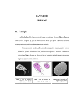 CAPÍTULO II
GIARDÍASE
2.1. Etiologia
A Giardia Lamblia é um protozoário que possui duas formas (Figura 1), uma
forma cística (Figura 2), que é eliminada nas fezes que pode sobreviver durante
meses no ambiente e é infecciosa para outros animais.
Estes cistos são arredondados, com dois ou quatro núcleos, quatro corpos
parabasais, quatro axonemas e com parede celular grossa e imóveis. A forma de
trofozoíta (Figura 3), que se desenvolve no intestino delgado a partir de cistos
ingeridos e causa sinais clínicos.
Figura 1. Foto das diferenças
morfológicas entre Giardia
lamblia cística e Giardia
lamblia trofozoíta
Figura 2. Foto da morfologia da
espécie Giardia lamblia na
forma cística
Figura 3. Foto da morfologia da
espécie Giardia lamblia
na forma trofozoíta
 