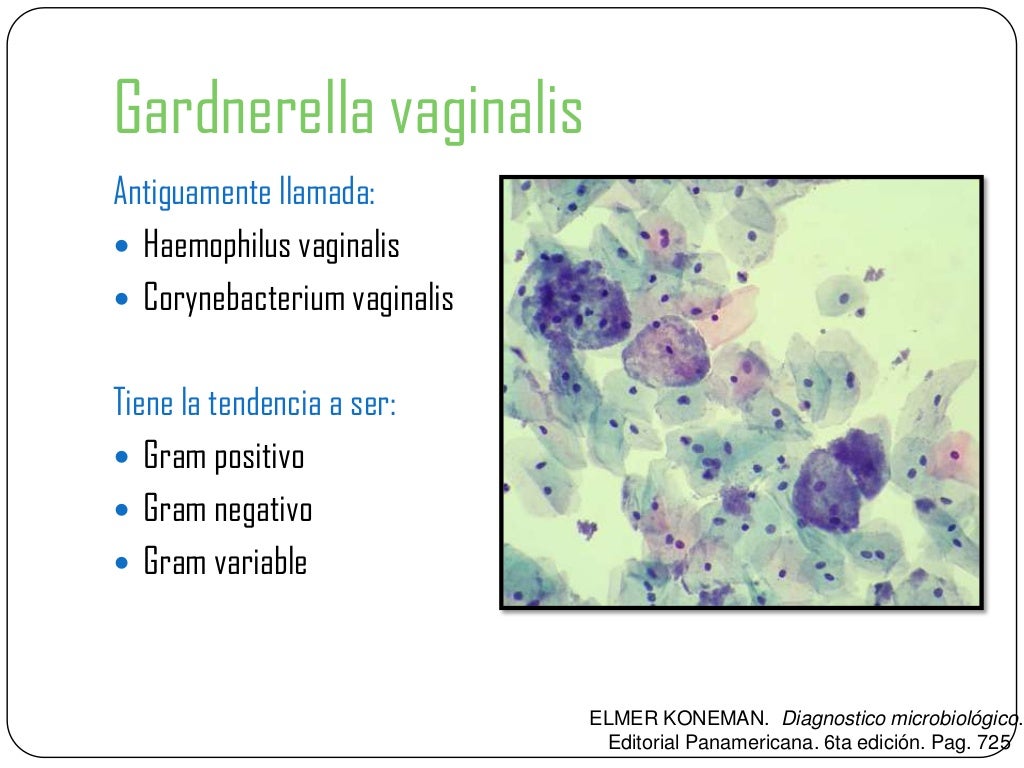 gardnerella cura definitiva