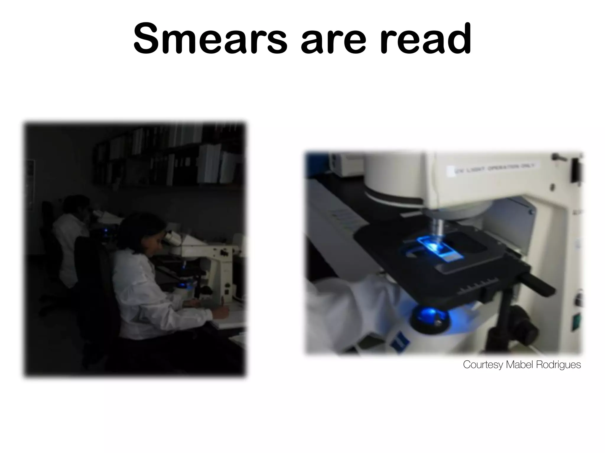 Smears are read
Courtesy Mabel Rodrigues
 