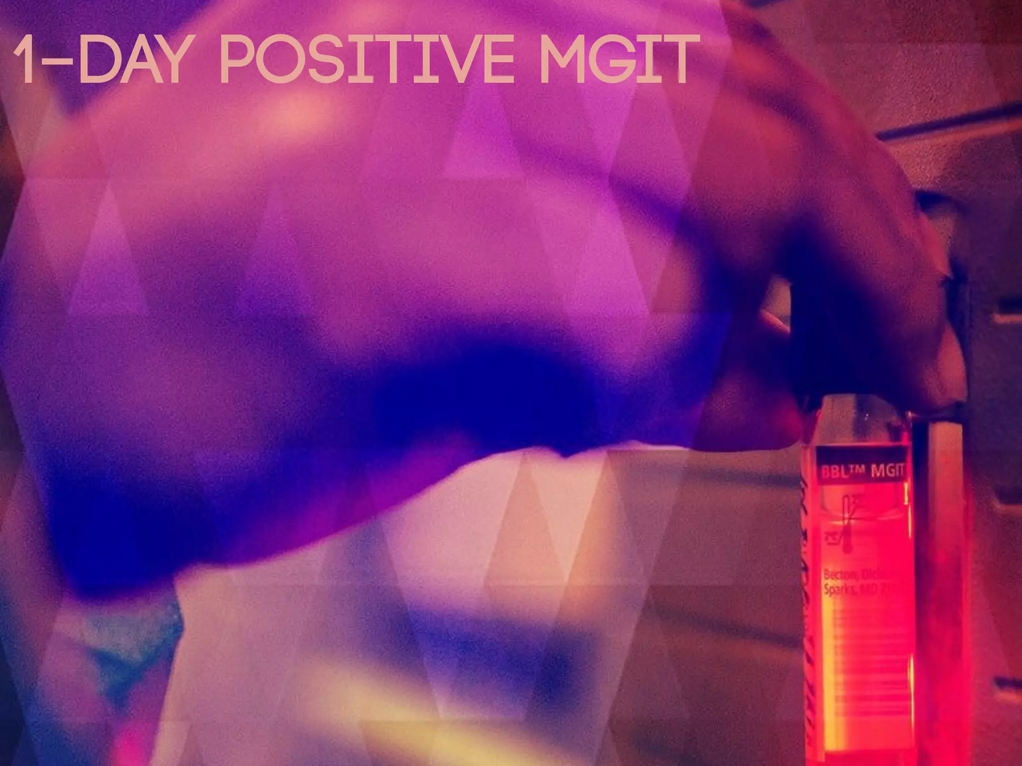1-day positive MGIT
 