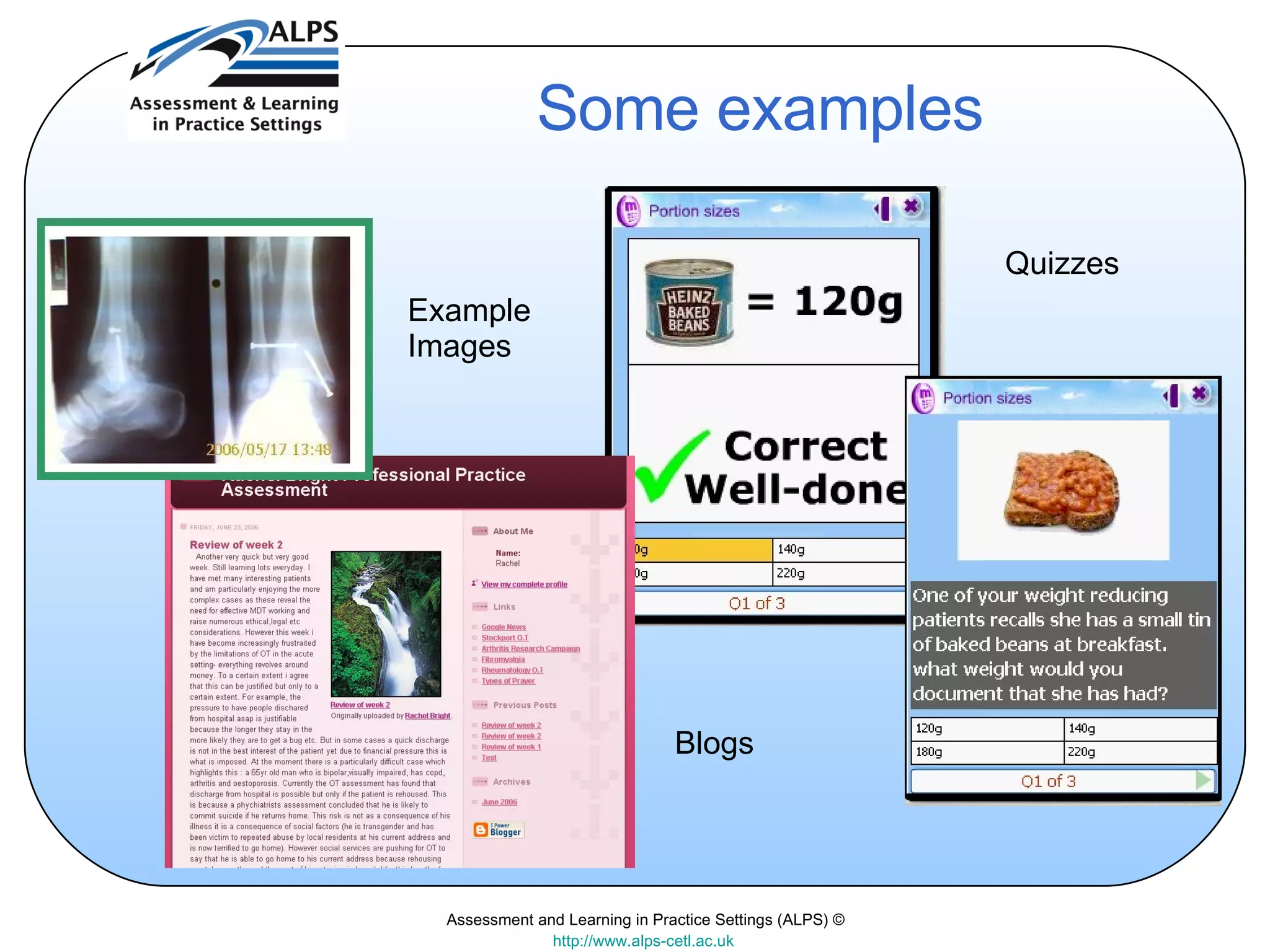 Assessment and Learning in Practice Settings (ALPS) © http://www.alps-cetl.ac.uk   Some examples Blogs Quizzes Example Images 