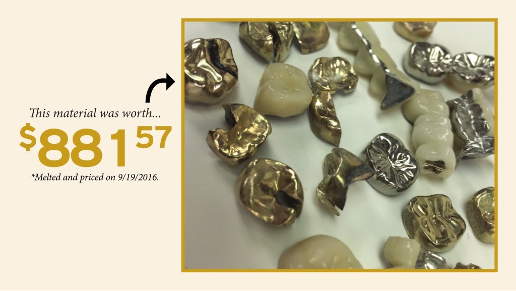 Garfield Refining Dental Scrap Is Valuable 2018 New South Wales