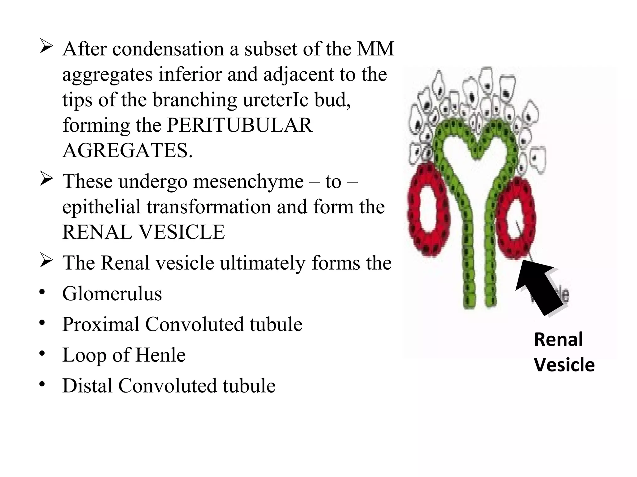  After condensation a subset of the MM 
aggregates inferior and adjacent to the 
tips of the branching ureterIc bud, 
forming the PERITUBULAR 
AGREGATES. 
 These undergo mesenchyme – to – 
epithelial transformation and form the 
RENAL VESICLE 
 The Renal vesicle ultimately forms the 
• Glomerulus 
• Proximal Convoluted tubule 
• Loop of Henle 
• Distal Convoluted tubule 
Renal 
Vesicle 
 