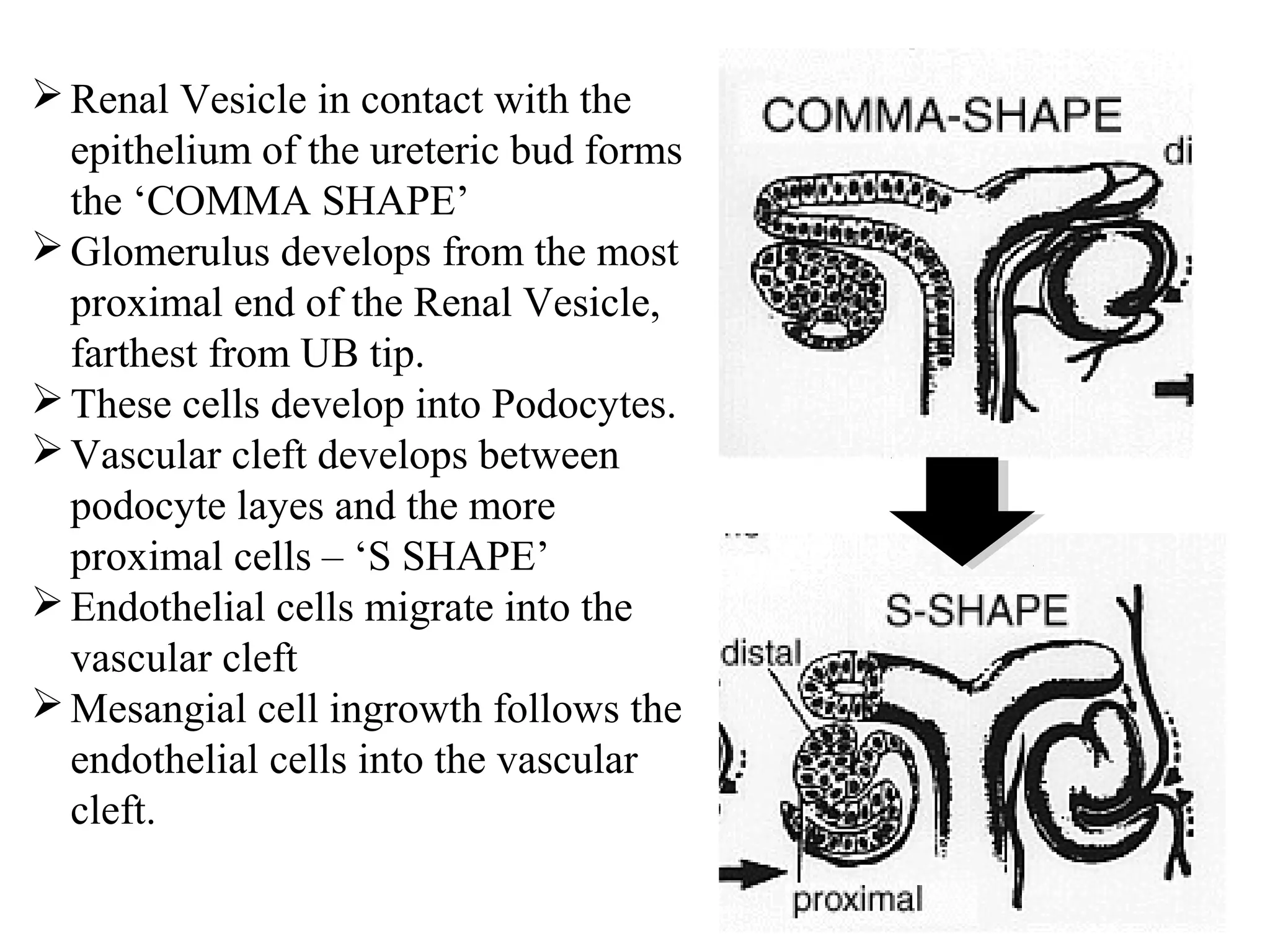 Renal Vesicle in contact with the 
epithelium of the ureteric bud forms 
the ‘COMMA SHAPE’ 
Glomerulus develops from the most 
proximal end of the Renal Vesicle, 
farthest from UB tip. 
These cells develop into Podocytes. 
Vascular cleft develops between 
podocyte layes and the more 
proximal cells – ‘S SHAPE’ 
Endothelial cells migrate into the 
vascular cleft 
Mesangial cell ingrowth follows the 
endothelial cells into the vascular 
cleft. 
 