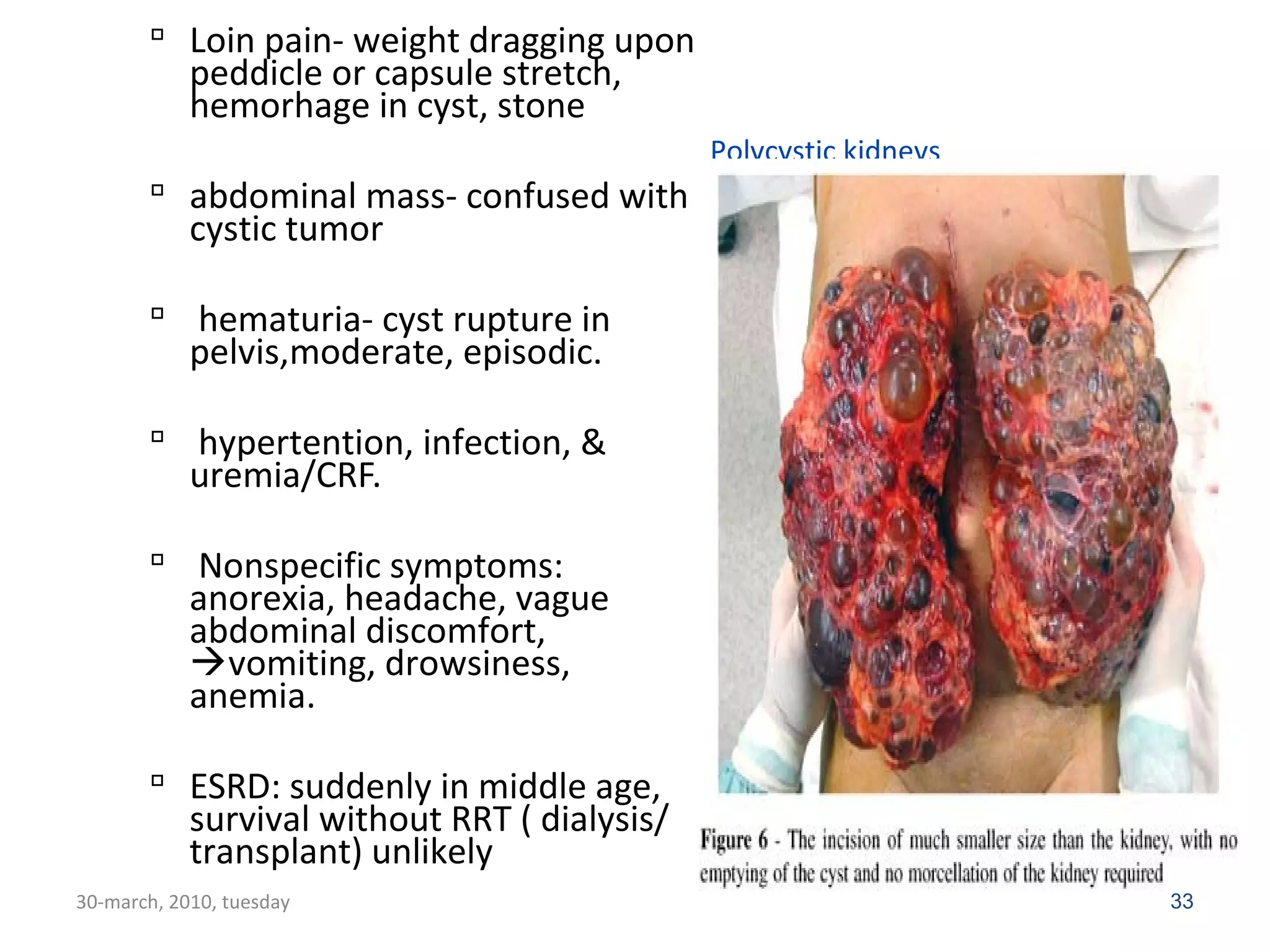 Polycystic kidneys 
 Loin pain- weight dragging upon 
peddicle or capsule stretch, 
hemorhage in cyst, stone 
 abdominal mass- confused with 
cystic tumor 
 hematuria- cyst rupture in 
pelvis,moderate, episodic. 
 hypertention, infection, & 
uremia/CRF. 
 Nonspecific symptoms: 
anorexia, headache, vague 
abdominal discomfort, 
vomiting, drowsiness, 
anemia. 
 ESRD: suddenly in middle age, 
survival without RRT ( dialysis/ 
transplant) unlikely 
30-march, 2010, tuesday 33 
