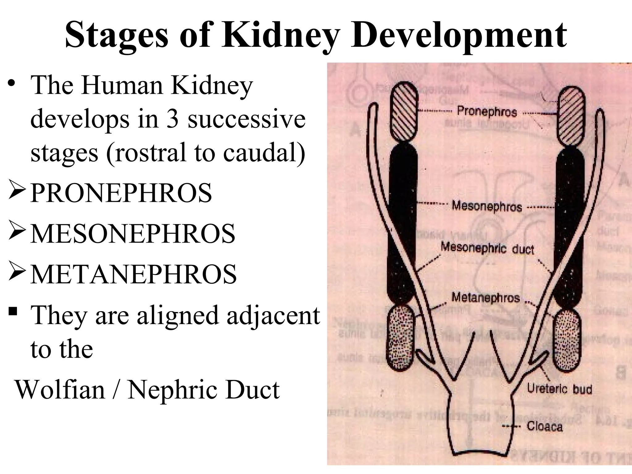 Stages of Kidney Development 
• The Human Kidney 
develops in 3 successive 
stages (rostral to caudal) 
PRONEPHROS 
MESONEPHROS 
METANEPHROS 
 They are aligned adjacent 
to the 
Wolfian / Nephric Duct 
 