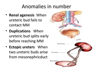 Anomalies in number 
• Renal agenesis When 
ureteric bud fails to 
contact MM 
• Duplications When 
ureteric bud splits early 
before reaching MM 
• Ectopic ureters When 
two ureteric buds arise 
from mesonephricduct 
 