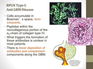 Crescentic Rpgn Approach to Rapidly Progressive Glomerulonephritis RPGN | PPTX