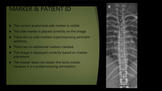 MARKER & PATIENT ID
 The correct anatomical side marker is visible.
 The side marker is placed correctly on the image.
 There are no side markers superimposing pertinent
anatomy.
 There are no additional markers needed.
 The image is displayed correctly based on marker
placement.
 The marker does not obtain the techs initials
because it is a postprocessing annotation.
 