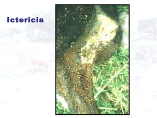 Ictericia   