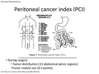 Peritoneal Mesothelioma



                Peritoneal cancer index (PCI)




      • During surgery
          • Tumor distribution (13 abdominal pelvic regions)
          •Tumor nodule size (0-3 points)
Yan TD, et al. Cancer. 2011 May 1;117(9):1855-63
 